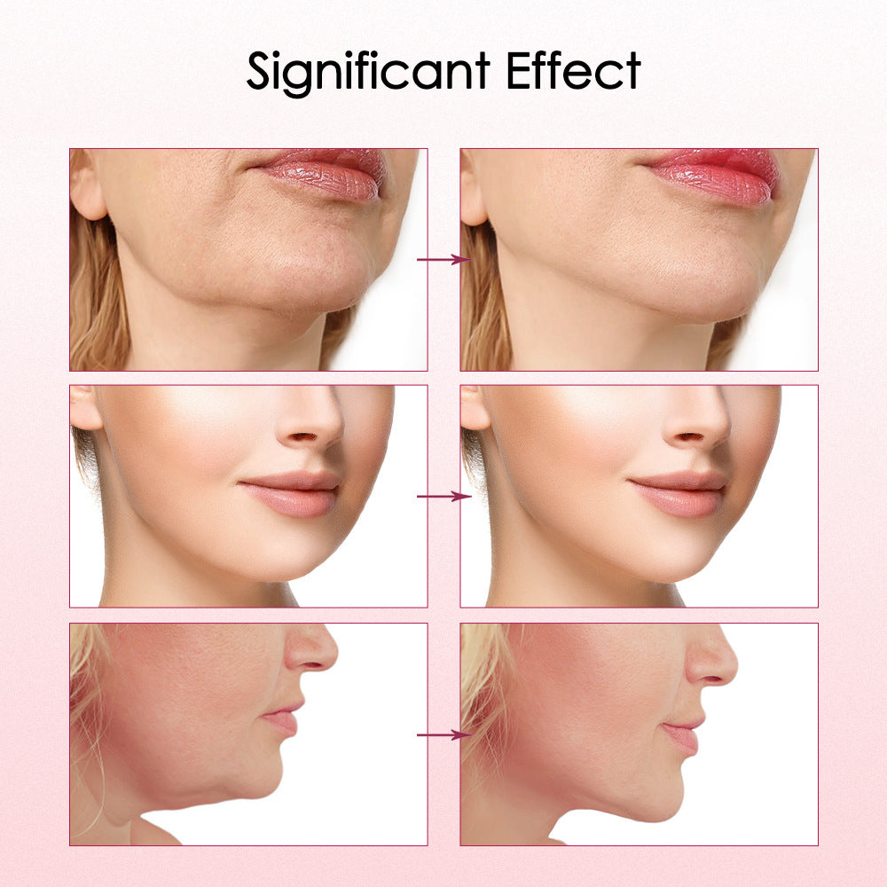 V-Face Lifting & Jaw Slimming Device